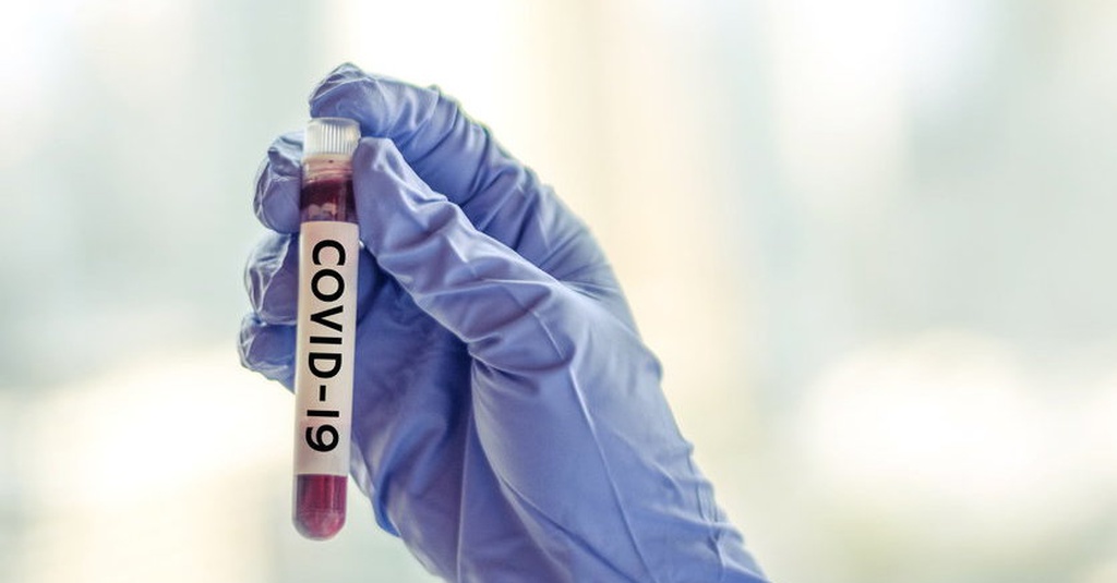 Coronavirus Bisa Hidup Beberapa Jam Di Udara Menurut Studi Terbaru Tirto Id