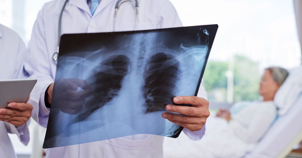 Permenkes Radiologi Rawan Bebani Sistem Kesehatan Di Masa Pandemi Tirto Id