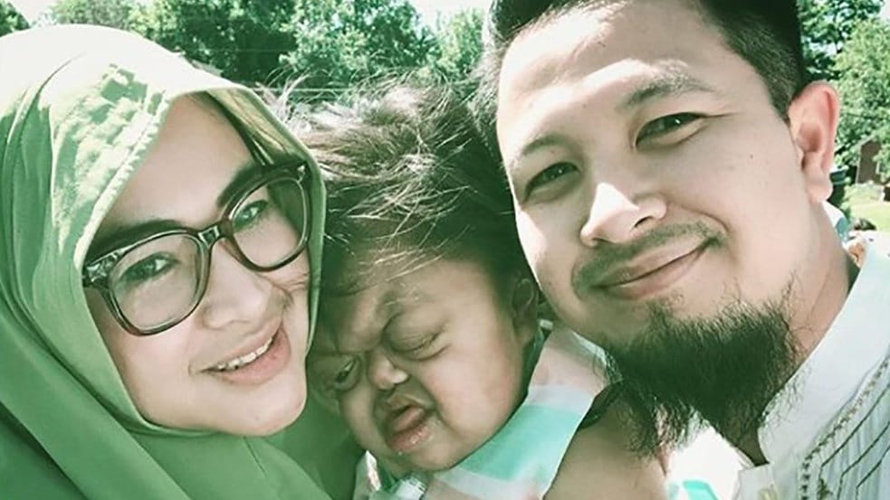 Apa yang Dimaksud dengan Sindrom Pfeiffer?