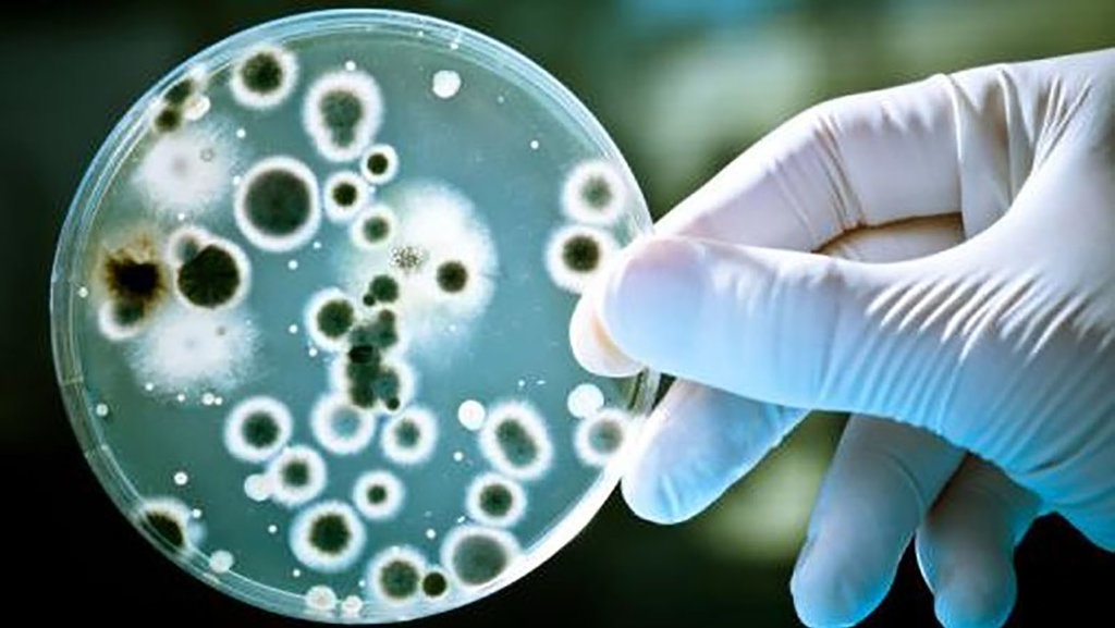 Brucellosis Tidak Menular Antar Manusia, Kata Pakar Zoonosis UGM Brucellosis Tidak Menular Antar Manusia, Kata Pakar Zoonosis UGM