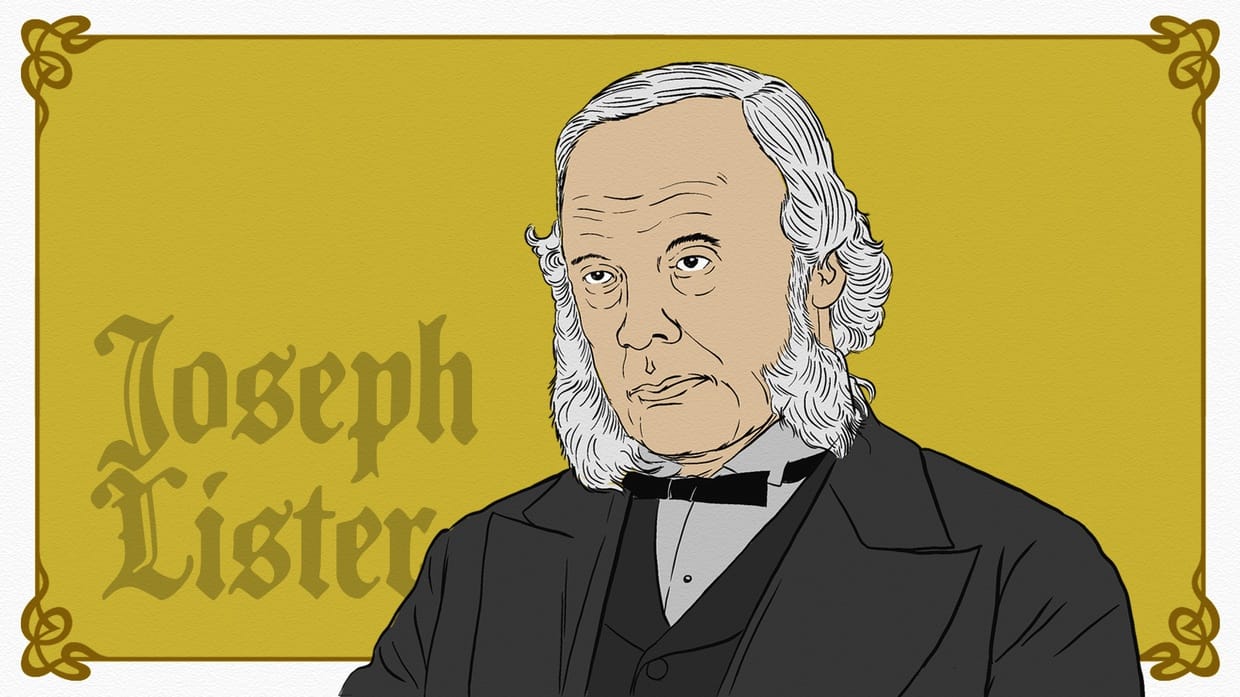 Ilmu Bedah dan Antiseptik: Dari Sweeney Todd Hingga Joseph Lister Ilmu Bedah dan Antiseptik: Dari Sweeney Todd Hingga Joseph Lister