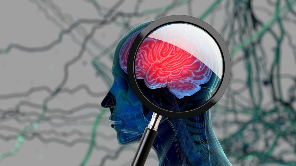 Alzheimer & Demensia: Perbedaan, Gejala, Mitos, dan Fakta-Faktanya Alzheimer & Demensia: Perbedaan, Gejala, Mitos, dan Fakta-Faktanya