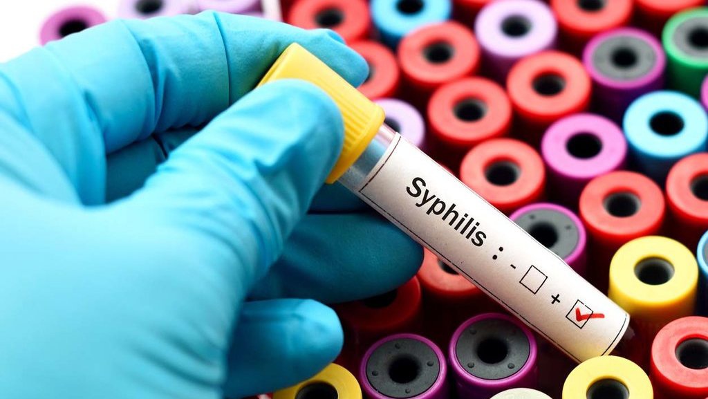 Kasus Sifilis pada Ibu Hamil Capai 27%, Kemenkes Dorong Tes Dini Kasus Sifilis pada Ibu Hamil Capai 27%, Kemenkes Dorong Tes Dini