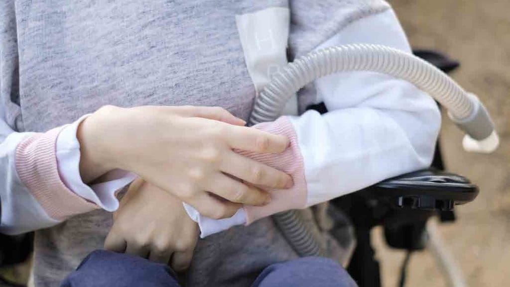 Apa Itu Spinal Muscular Atrophy: Penyebab, Gejala, dan Jenis SMA Apa Itu Spinal Muscular Atrophy: Penyebab, Gejala, dan Jenis SMA