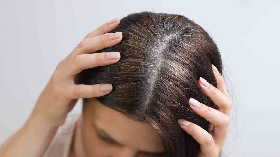 4 Tips Memperlambat Munculnya Rambut Uban & Ketahui Penyebabnya 4 Tips Memperlambat Munculnya Rambut Uban & Ketahui Penyebabnya