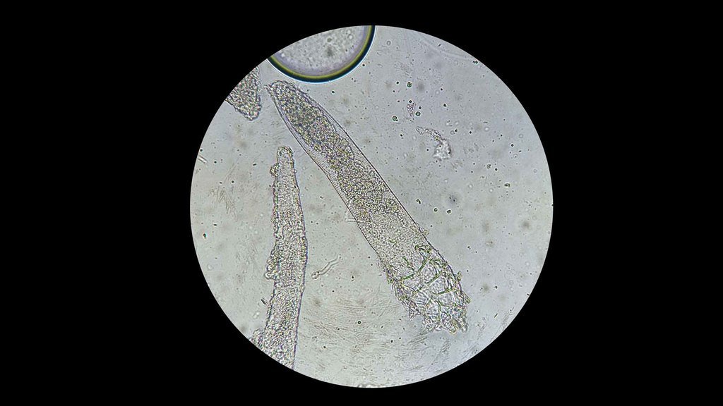 Cara Menghilangkan Tungau Demodex di Wajah & Penyebabnya Cara Menghilangkan Tungau Demodex di Wajah & Penyebabnya