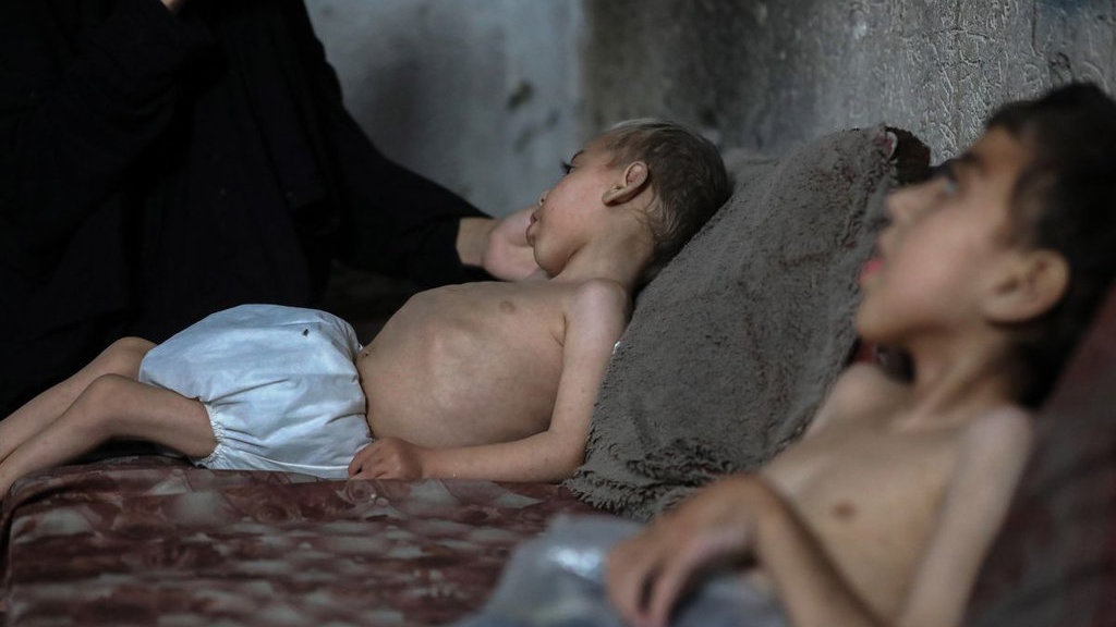 Update Gaza Hari Ini: Kematian karena Kelaparan Meningkat Update Gaza Hari Ini: Kematian karena Kelaparan Meningkat