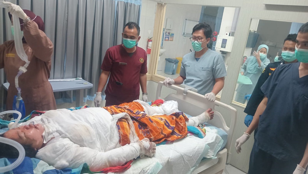 Jari Tangan Korban Selamat Kecelakaan Bus ALS akan Diamputasi Jari Tangan Korban Selamat Kecelakaan Bus ALS akan Diamputasi
