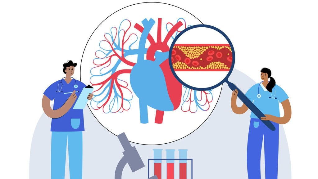 Kolesterol Tinggi di Usia Muda Apakah karena Faktor Genetik? Kolesterol Tinggi di Usia Muda Apakah karena Faktor Genetik?