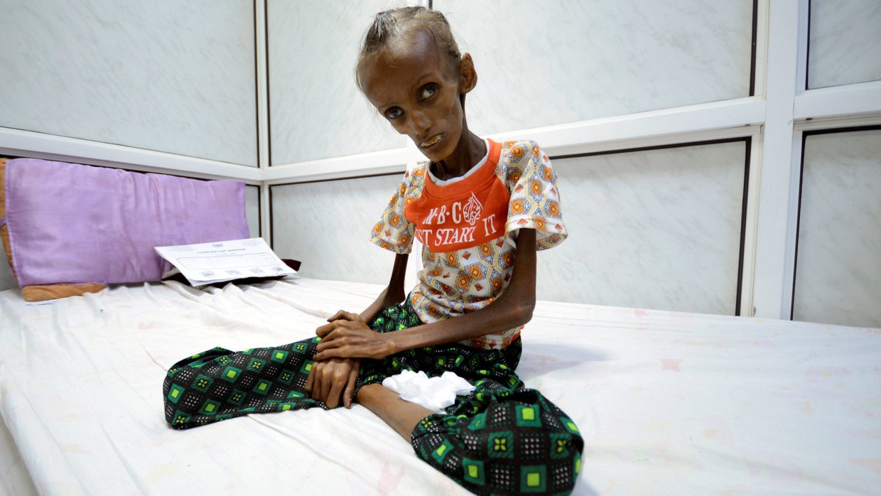 Jutaan Warga Yaman Hadapi Krisis Pangan Saat Ramadan