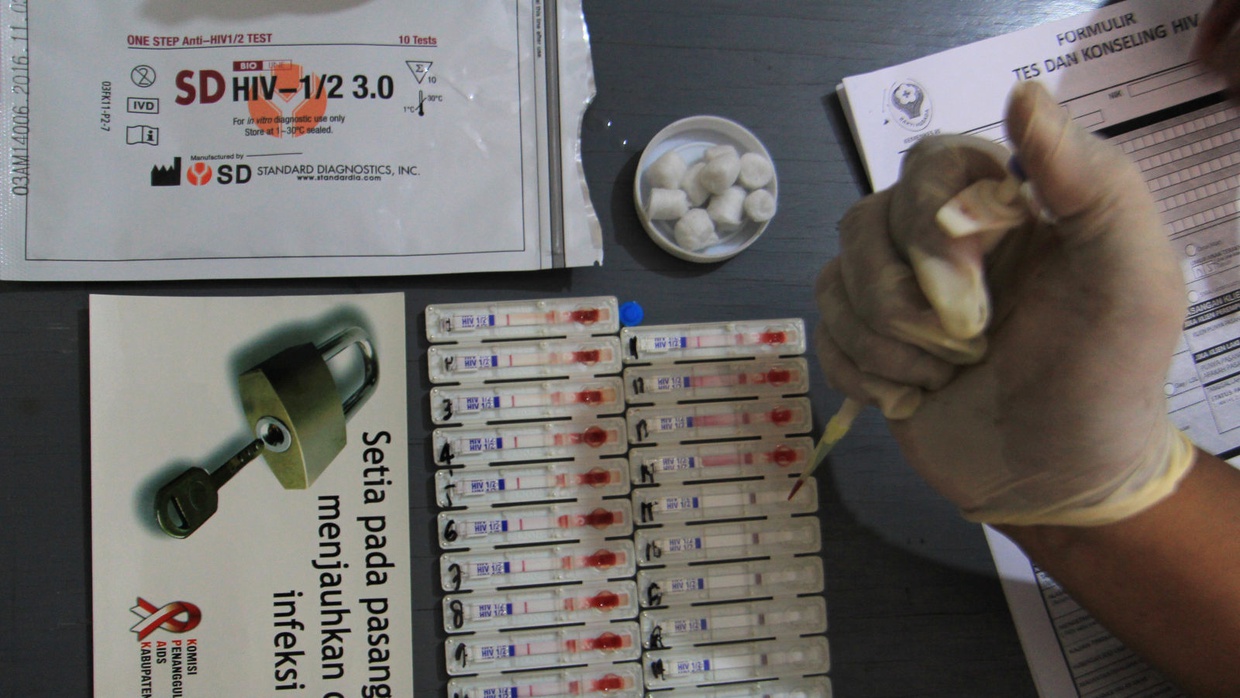 Gejala HIV-AIDS: Tanda-Tanda Awal & Ciri Infeksi Akut hingga Laten