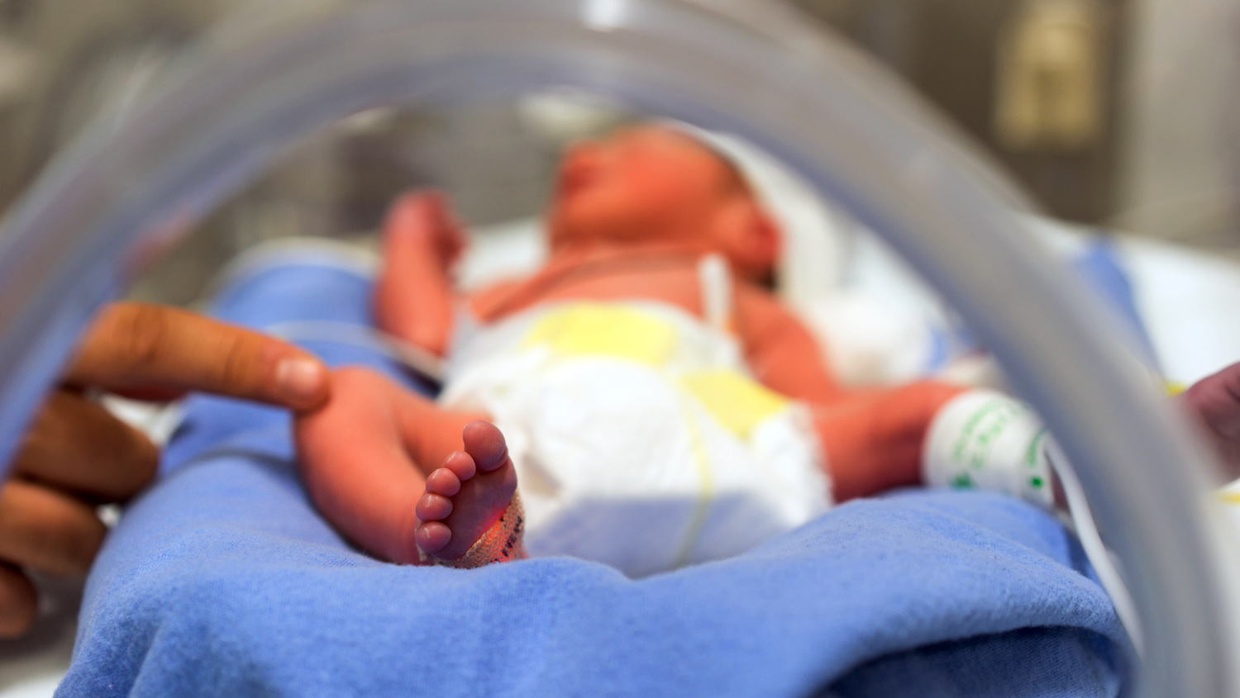 Risiko di Masa Depan Bagi Bayi Prematur