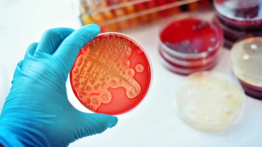 Mengapa Gonorea/Penyakit Kencing Nanah Merebak Lagi? Mengapa Gonorea/Penyakit Kencing Nanah Merebak Lagi?