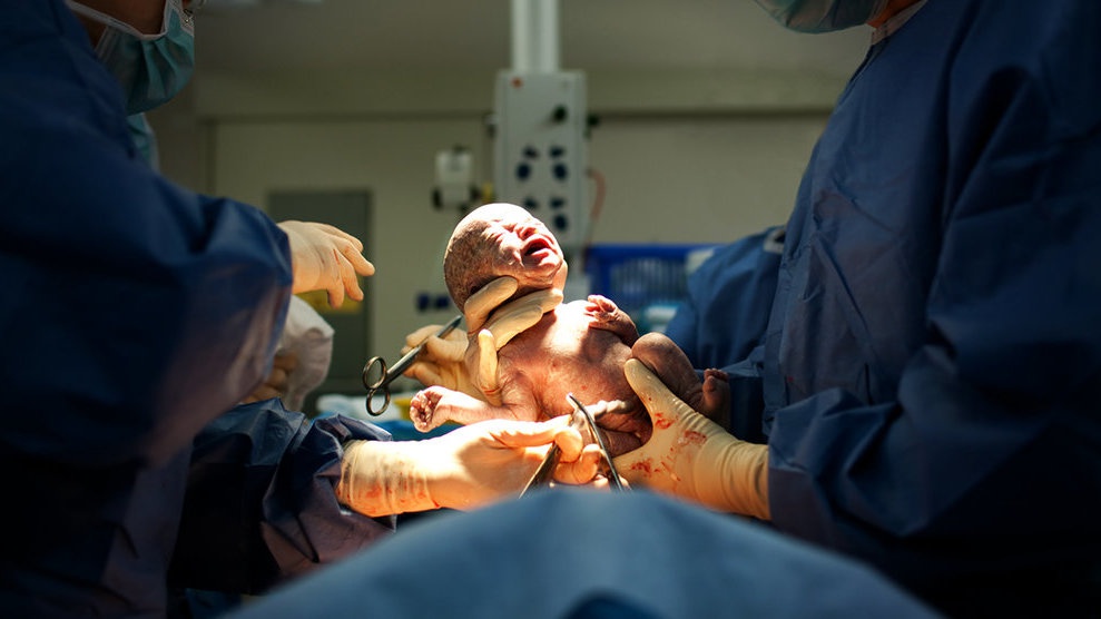 Risiko Nyawa: Nakes Pedalaman Khawatir Caesar oleh Dokter Umum Risiko Nyawa: Nakes Pedalaman Khawatir Caesar oleh Dokter Umum