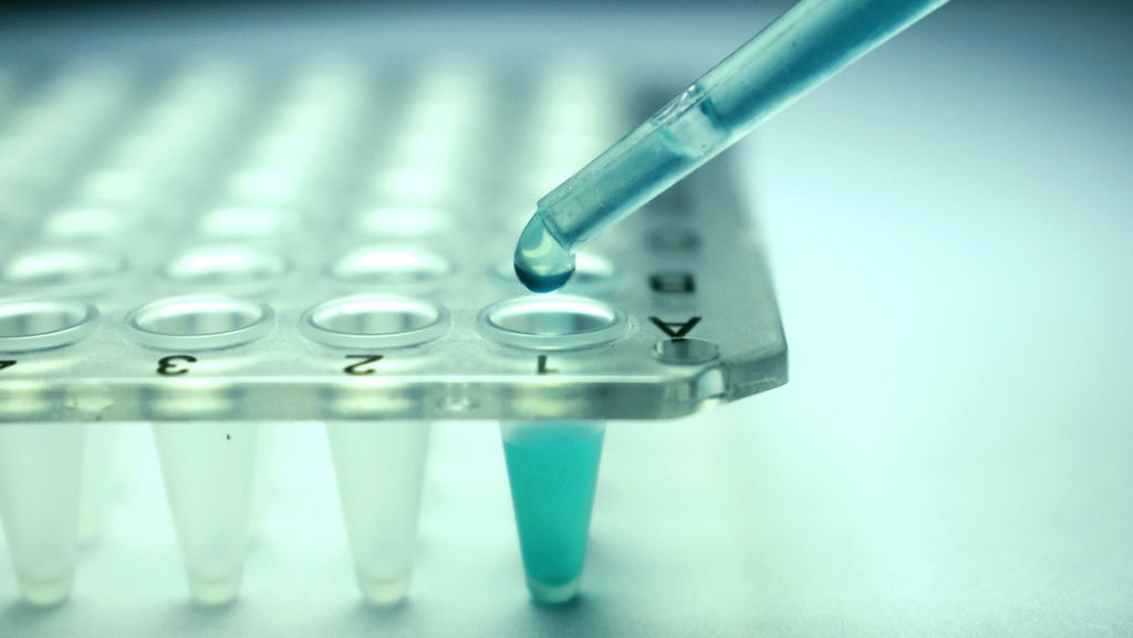 Contoh Penggunaan Mikroogranisme dalam Bioteknologi Konvensional Contoh Penggunaan Mikroogranisme dalam Bioteknologi Konvensional