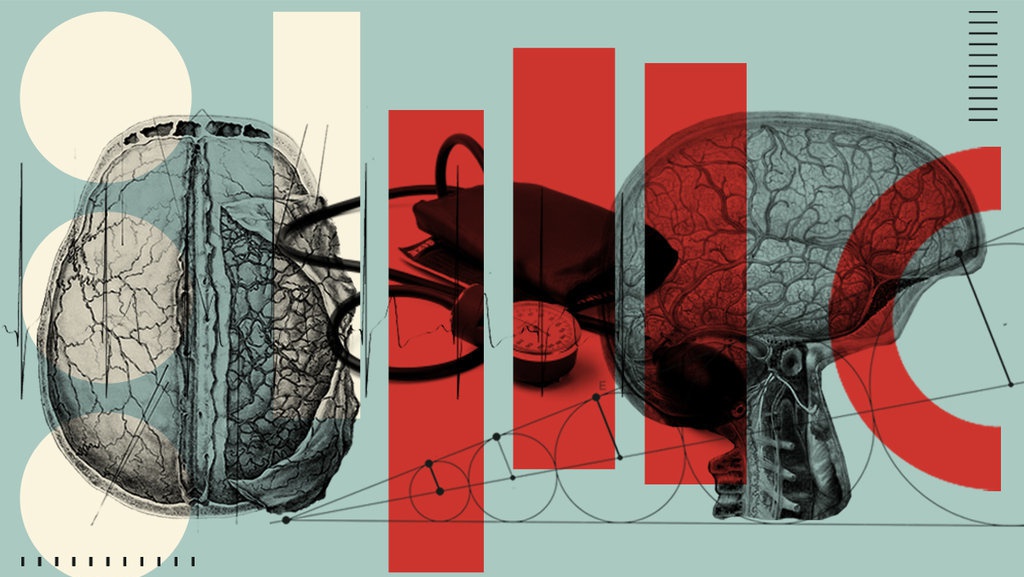 Apa Saja 17 Gejala Stroke Ringan pada Wajah & Daftar Penyebabnya Apa Saja 17 Gejala Stroke Ringan pada Wajah & Daftar Penyebabnya