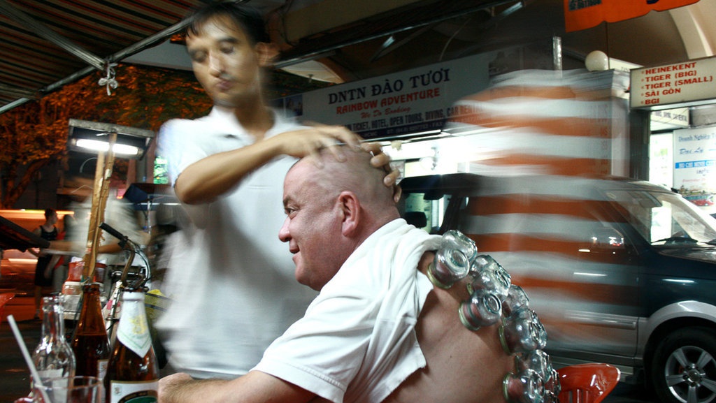 Terapi Bekam, Apakah Benar Penyembuh Segala Macam Penyakit?