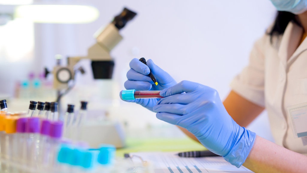 Jangan Jorok Kalau Tak Mau Demam Tifoid