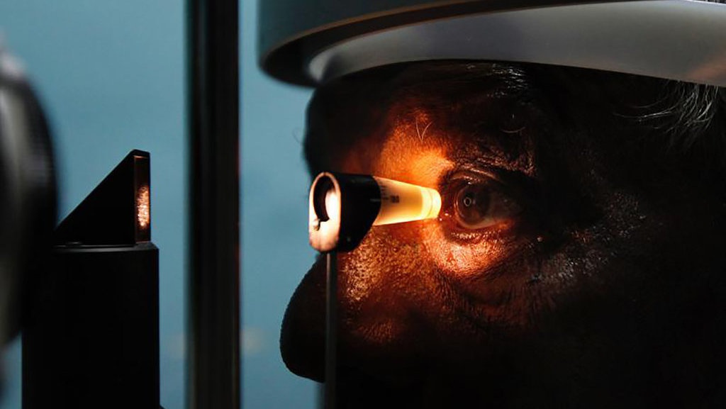 Menjajaki Kornea Babi sebagai Solusi Kebutaan Manusia Menjajaki Kornea Babi sebagai Solusi Kebutaan Manusia