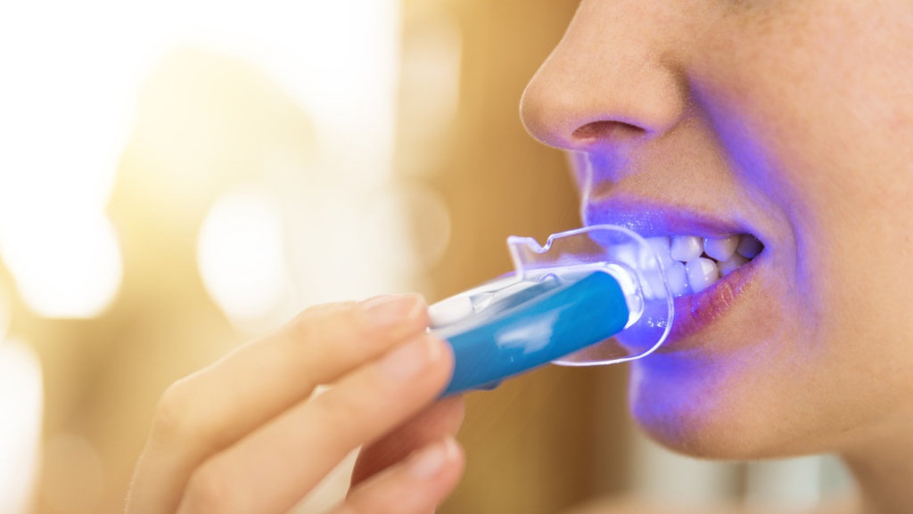 Studi Sebut Produk Pemutih Gigi Sebabkan Rusaknya Kolagen Studi Sebut Produk Pemutih Gigi Sebabkan Rusaknya Kolagen