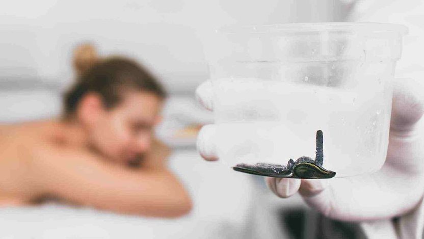 Manfaat Terapi Lintah untuk Kesehatan dan Mengobati Penyakit Manfaat Terapi Lintah untuk Kesehatan dan Mengobati Penyakit