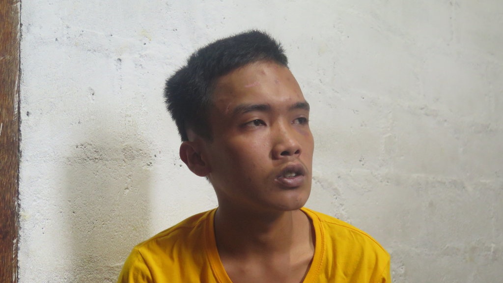 Mahasiswa Jogja Korban Salah Tangkap: Babak Belur Dipukul Polisi Mahasiswa Jogja Korban Salah Tangkap: Babak Belur Dipukul Polisi