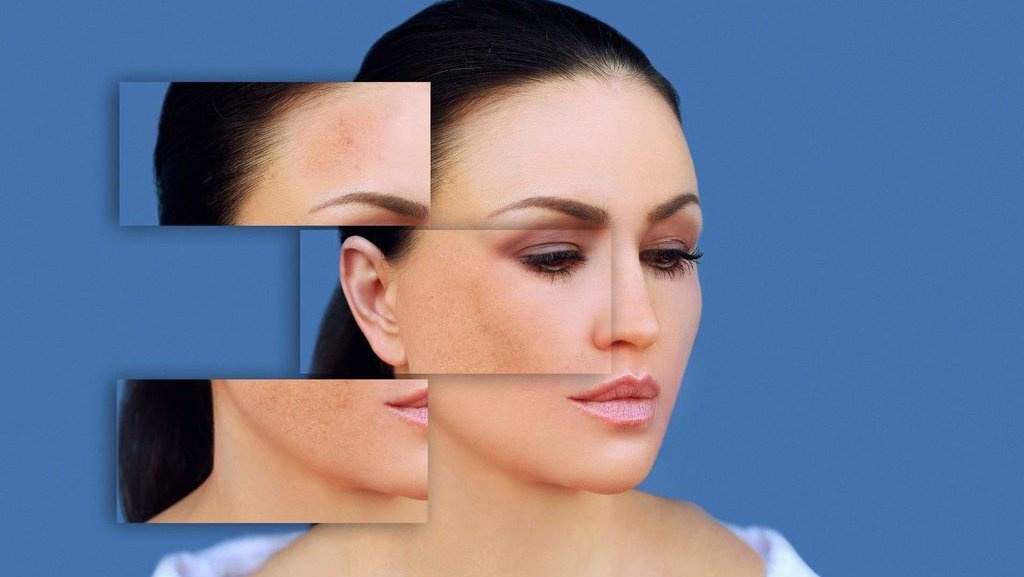 5 Bahan Alami untuk Mengatasi Pigmentasi Kulit & Tips Pencegahan 5 Bahan Alami untuk Mengatasi Pigmentasi Kulit & Tips Pencegahan