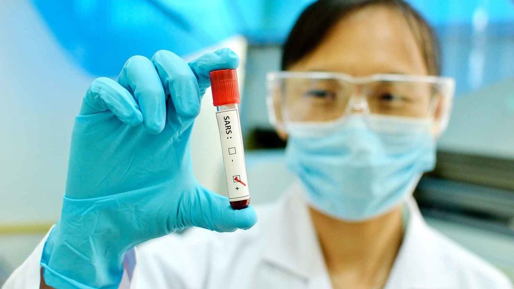 Bagaimana Virus Corona Bisa Menyebar dan Sebabkan Pneumonia di Cina