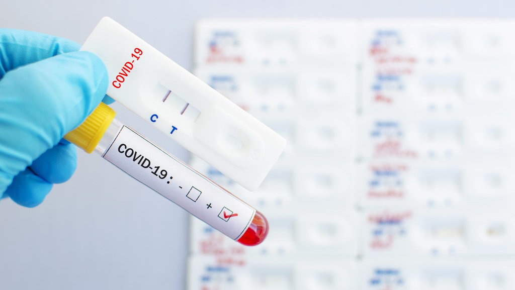 Lima Penyakit Pandemi yang Pernah Terjadi Selain Covid-19 Lima Penyakit Pandemi yang Pernah Terjadi Selain Covid-19