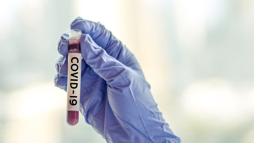 Coronavirus Bisa Hidup Beberapa Jam di Udara, Menurut Studi Terbaru Coronavirus Bisa Hidup Beberapa Jam di Udara, Menurut Studi Terbaru