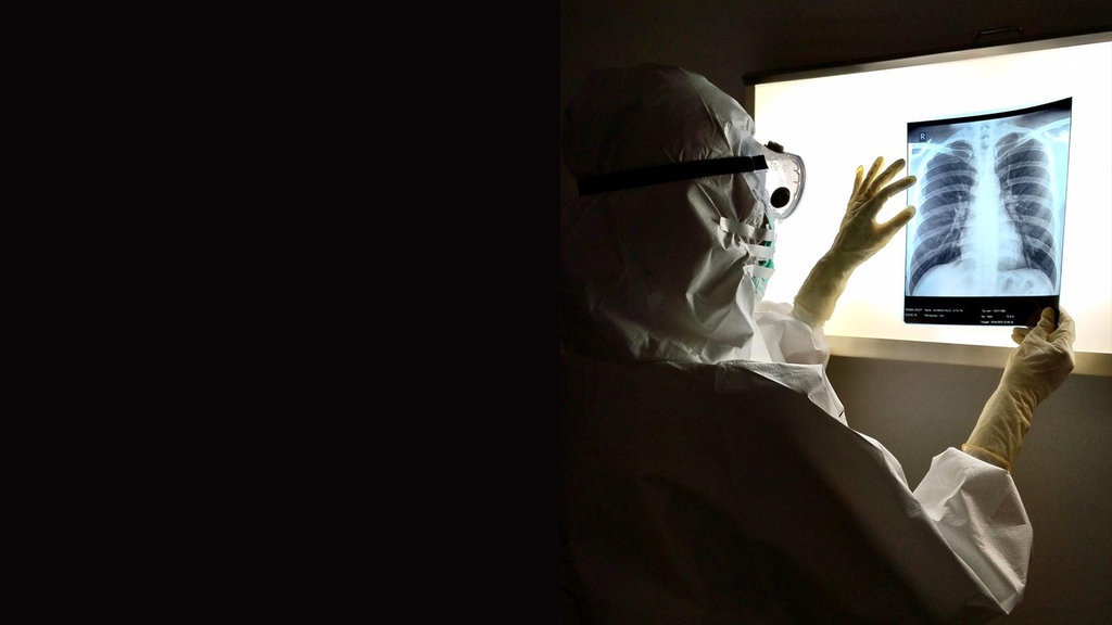 Kisah Edwin Marpaung, 'The Smiling Doctor', Meninggal karena Corona