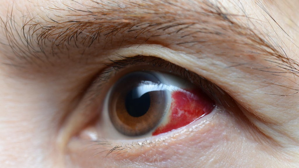 Apa Itu Ommetaphobia atau Rasa Takut Terhadap Mata? Apa Itu Ommetaphobia atau Rasa Takut Terhadap Mata?