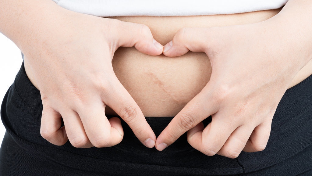 Cara Bangun dari Tempat Tidur Usai Operasi Sesar, Menurut Dokter Cara Bangun dari Tempat Tidur Usai Operasi Sesar, Menurut Dokter