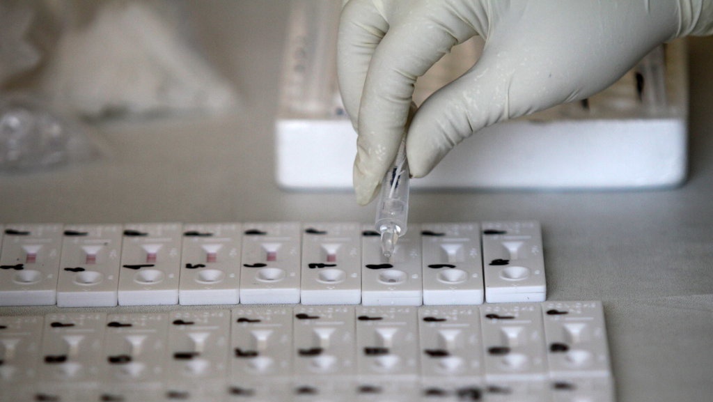 Kelebihan Bayar Antigen Rp1,19 M, Kadinkes DKI: Hanya Administrasi