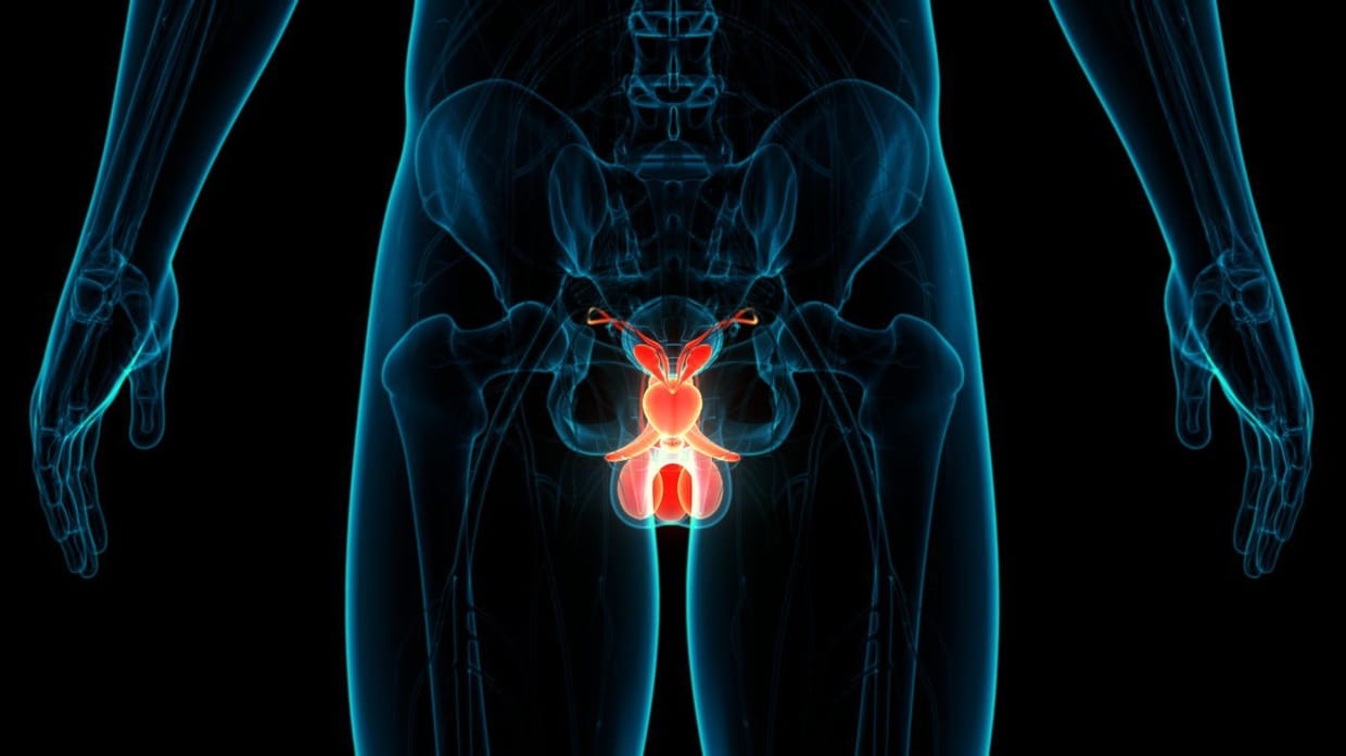 Mengenal Jenis Pengobatan Kanker Prostat & Cara Pencegahannya