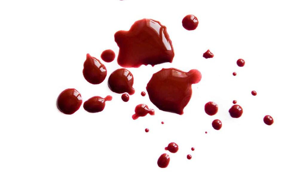 Apa Itu Hemophobia: Gejala, Penyebab dan Pengobatannya Apa Itu Hemophobia: Gejala, Penyebab dan Pengobatannya