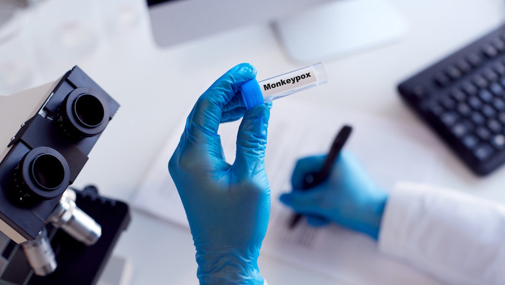 Mewaspadai Cacar Monyet & Antisipasi Wabah di Masa Mendatang Mewaspadai Cacar Monyet & Antisipasi Wabah di Masa Mendatang