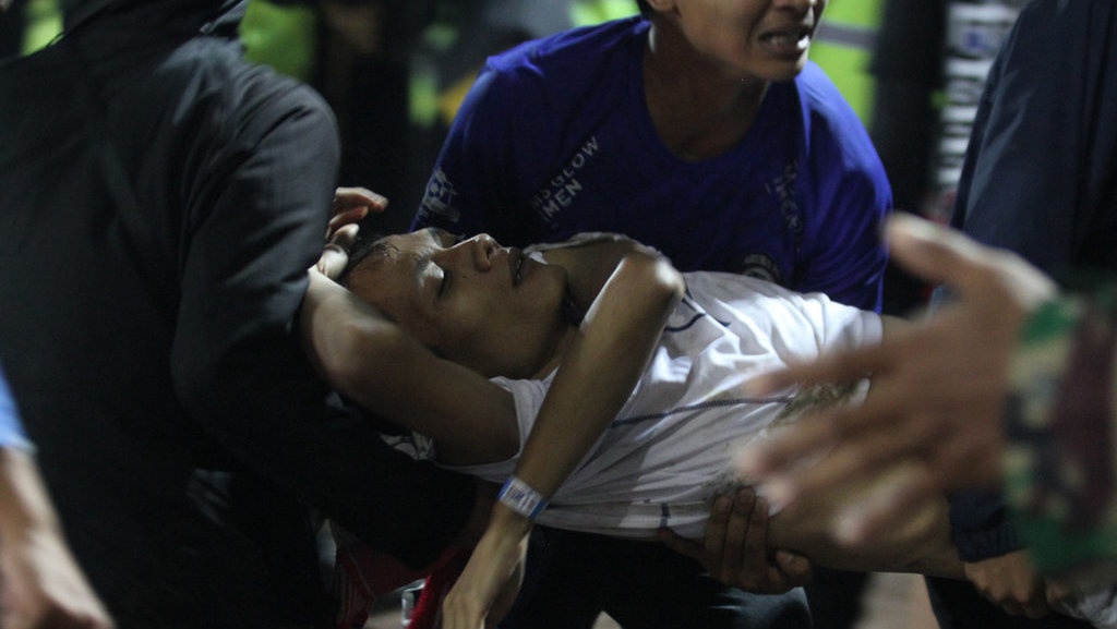 Menyoal Logika Polri Gas Air Mata Bukan Penyebab Kematian Menyoal Logika Polri Gas Air Mata Bukan Penyebab Kematian