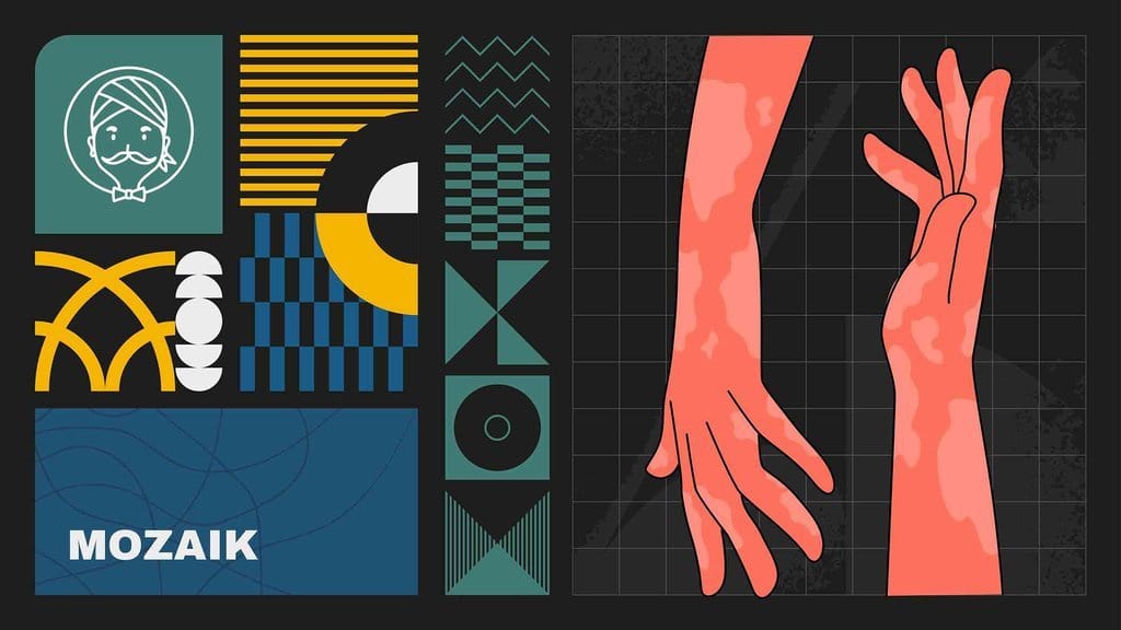 Penyakit Lepra dan Para Penderita yang Diasingkan di Molokai Penyakit Lepra dan Para Penderita yang Diasingkan di Molokai