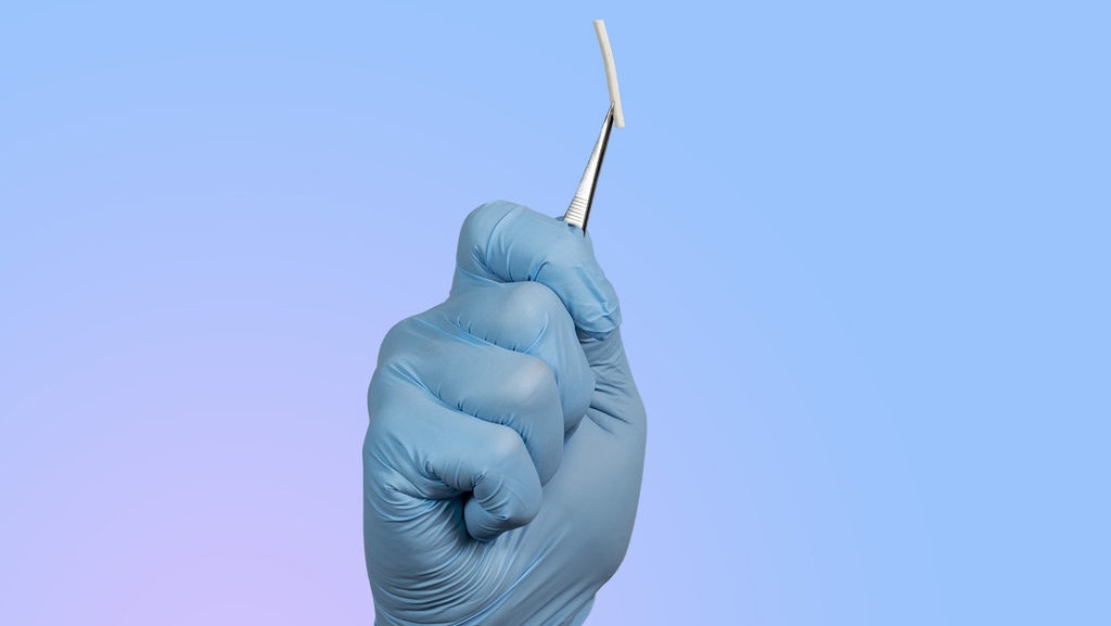 Efek KB Implan & Kapan Waktu Terbaik Pemasangan KB Implan? Efek KB Implan & Kapan Waktu Terbaik Pemasangan KB Implan?