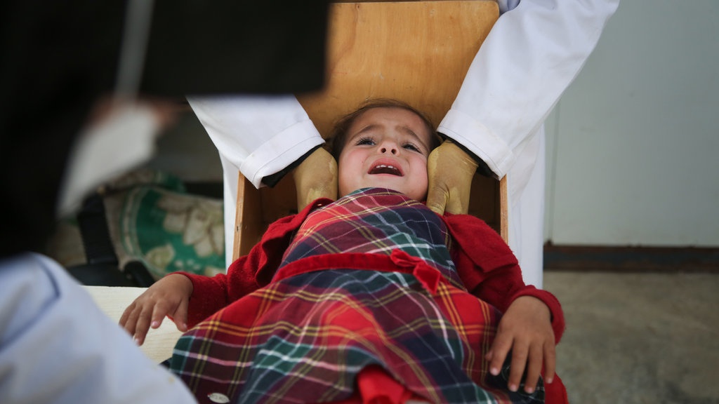 11 Tanda dan Dampak Ketika Tubuh Kekurangan Protein 11 Tanda dan Dampak Ketika Tubuh Kekurangan Protein