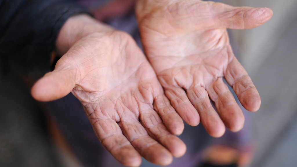 Kulit Jari Berkerut, Kapan Perlu Waspada?