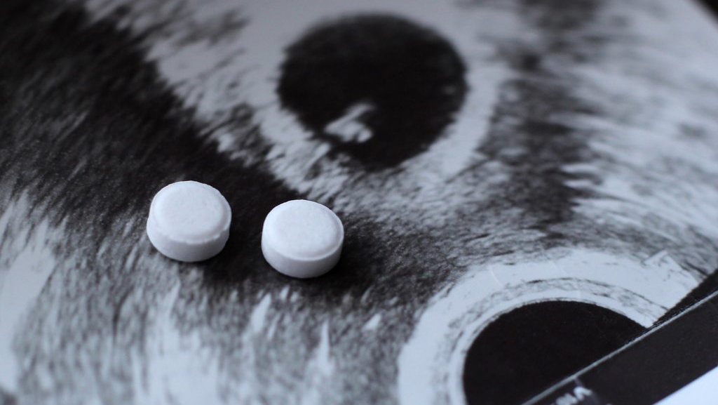 Aborsi dan Kaitannya dengan Perlindungan Kesehatan Perempuan Aborsi dan Kaitannya dengan Perlindungan Kesehatan Perempuan