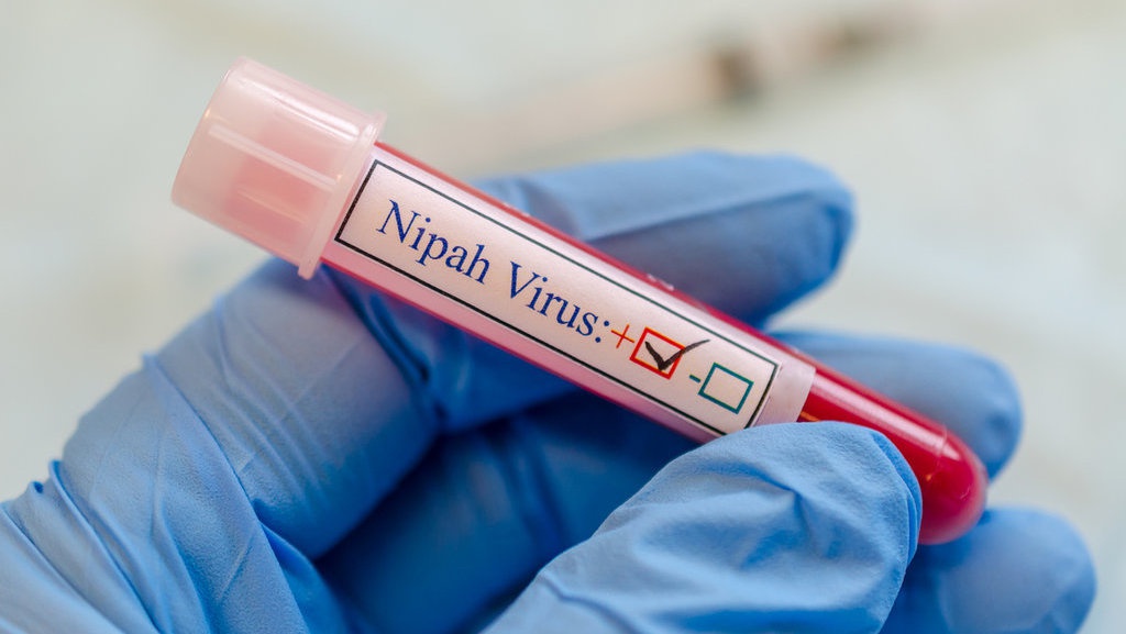 Kemenkes Imbau Warga & Pemda Waspada Ancaman Virus Nipah Kemenkes Imbau Warga & Pemda Waspada Ancaman Virus Nipah