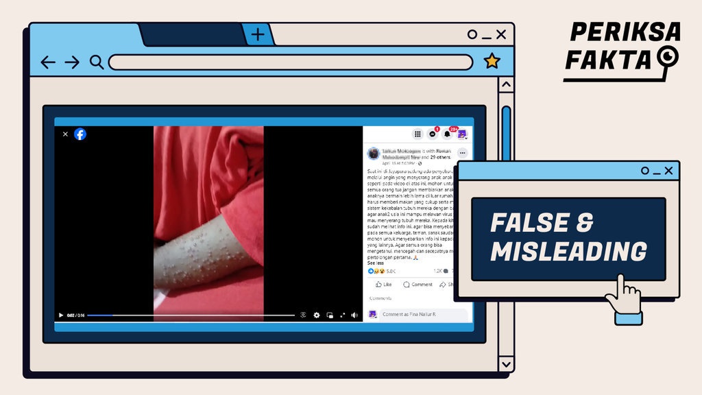 Apa Benar Ada Virus Angin yang Menyerang Anak di Jayapura?