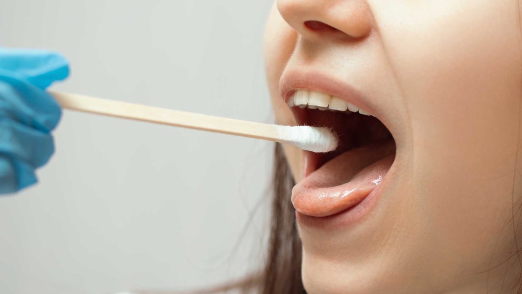 6 Penyebab Air Liur Berlebihan dan Cara Mengatasinya 6 Penyebab Air Liur Berlebihan dan Cara Mengatasinya