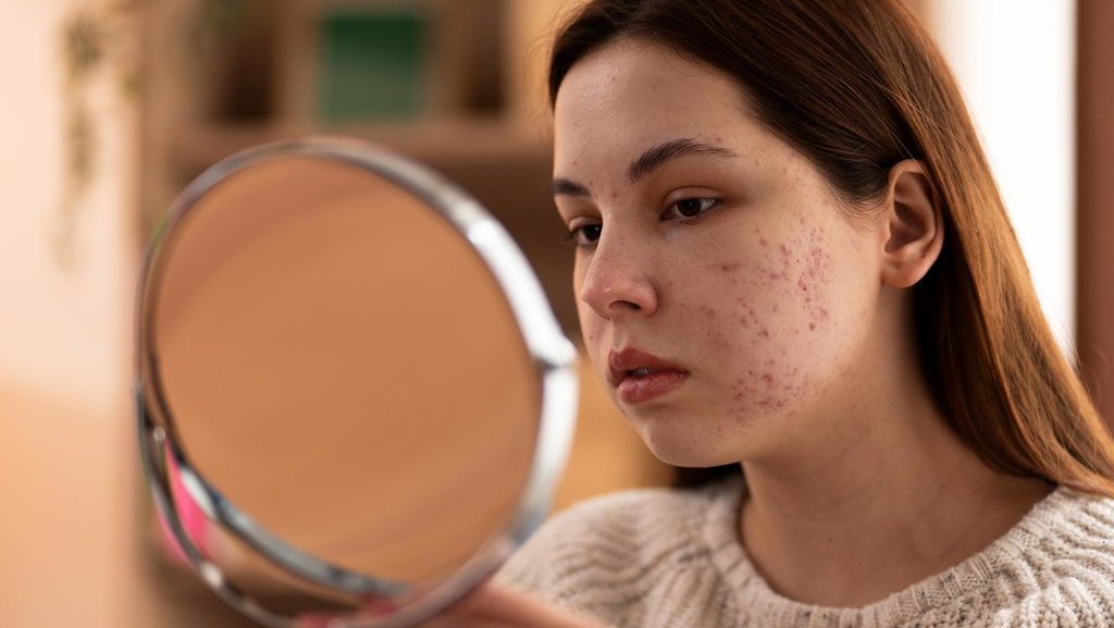 Pahami Penyebab Skin Barrier Rusak dan Cara Memperbaikinya