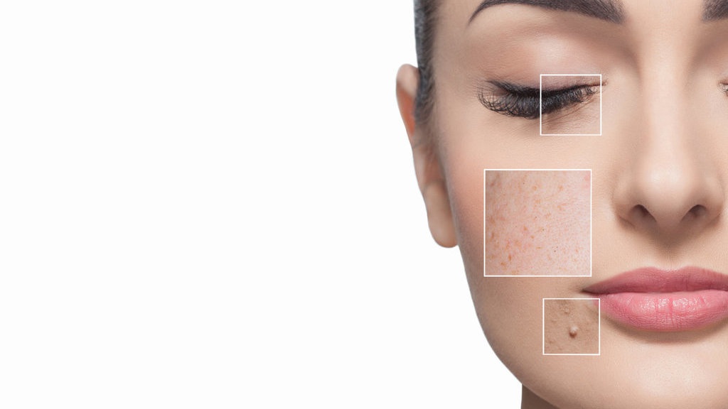 10 Produk Skintific untuk Menghilangkan Flek Hitam Usia 40an 10 Produk Skintific untuk Menghilangkan Flek Hitam Usia 40an