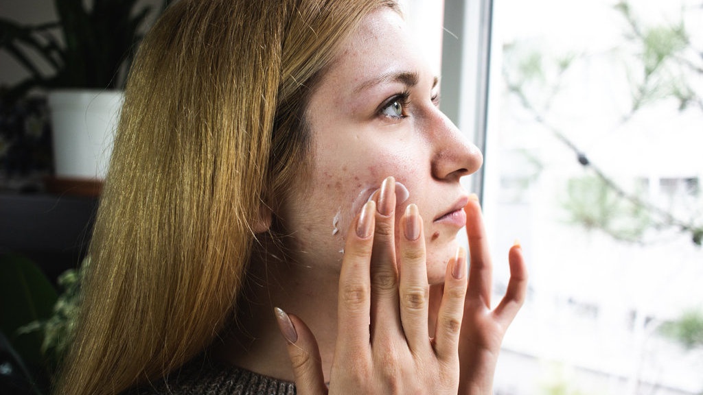 7 Sunscreen untuk Kulit Berjerawat dan Tips Memilih yang Tepat 7 Sunscreen untuk Kulit Berjerawat dan Tips Memilih yang Tepat