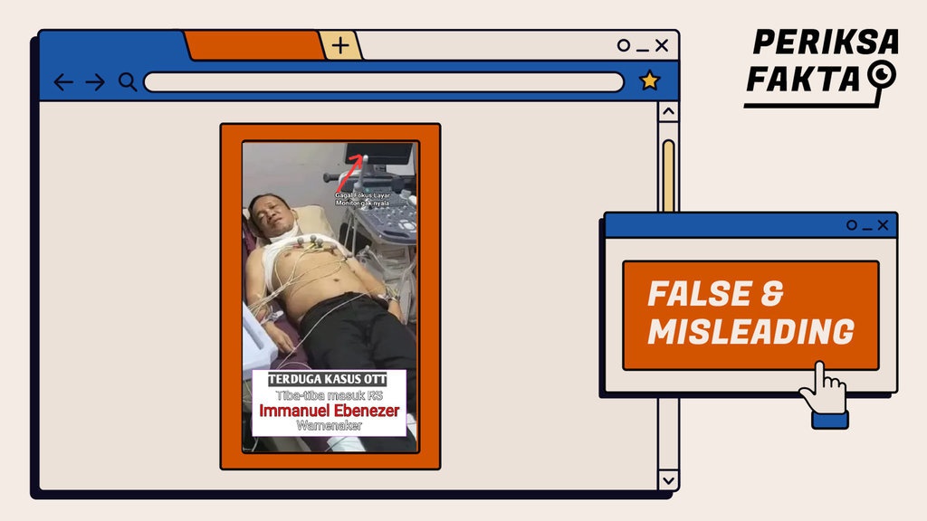 Tidak Benar Foto Noel Dirawat di Rumah Sakit Usai Terjaring OTT Tidak Benar Foto Noel Dirawat di Rumah Sakit Usai Terjaring OTT